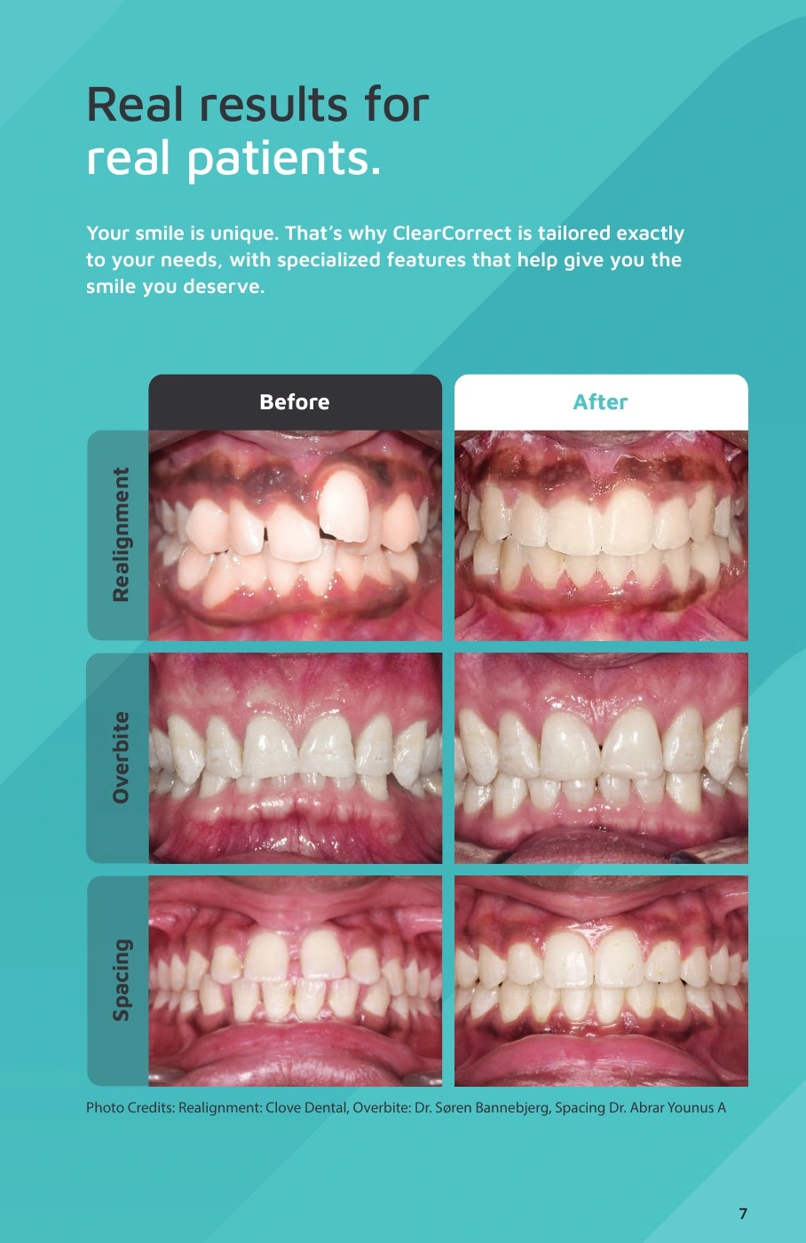 ClearCorrect® — Real results for real patients. Original artwork; complete text alongside.